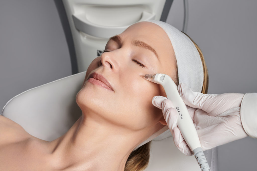 Microneedling treatments in Cincinnati OH & Covington KY