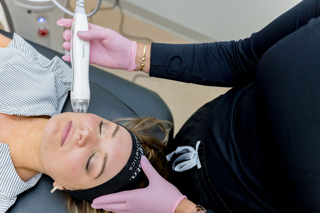 what does rf microneedling treat augusta what does rf microneedling treat augusta